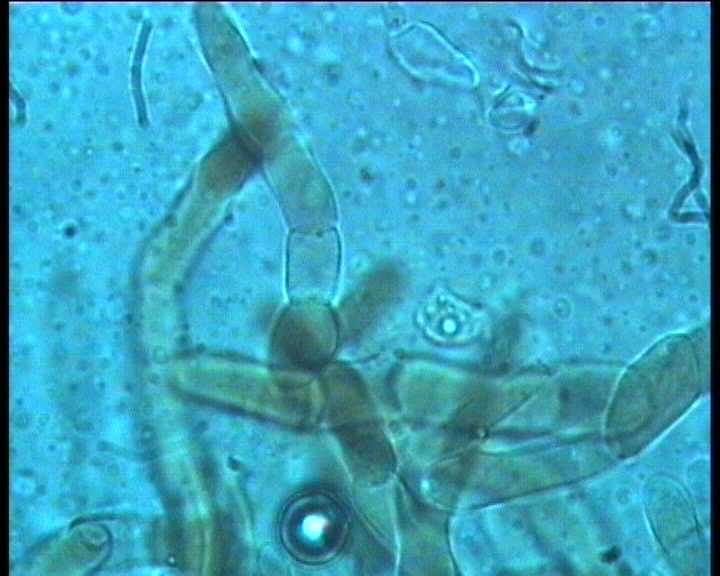 Leccinum crocipodium  (letellier)  Watling